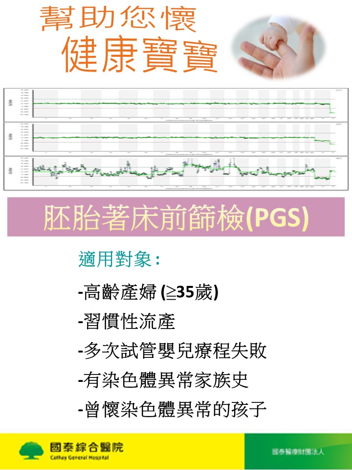 PGS技術