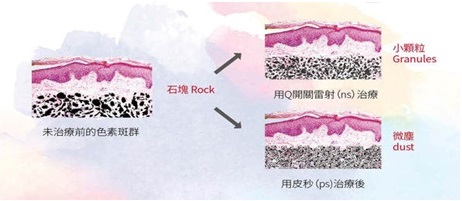 Discovery pico探索皮秒