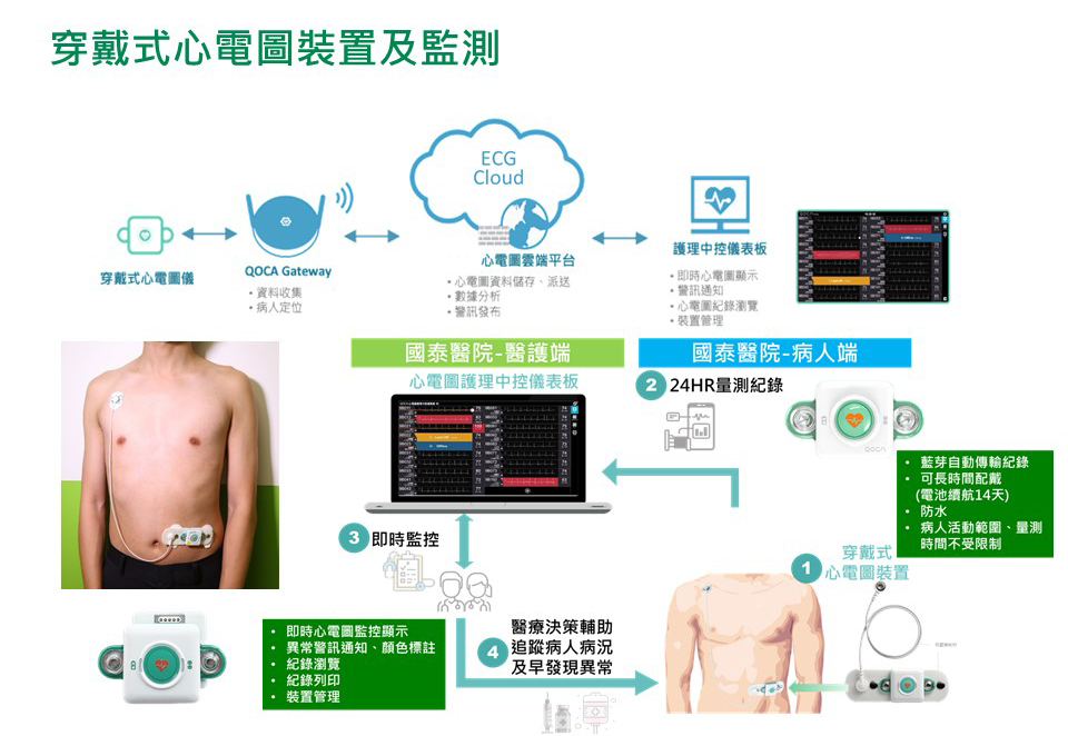 穿戴式心電圖裝置及監測